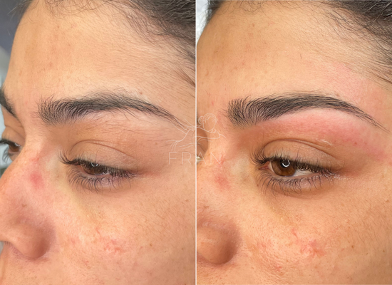 eyebrow-shaping-before-after-london-fran-massage-wellness-12.webp